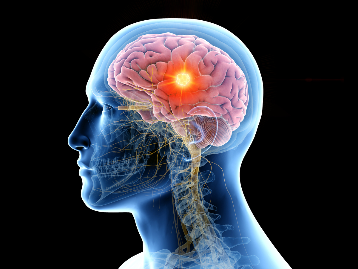 Disabling internet on your smartphone may actually reverse brain aging