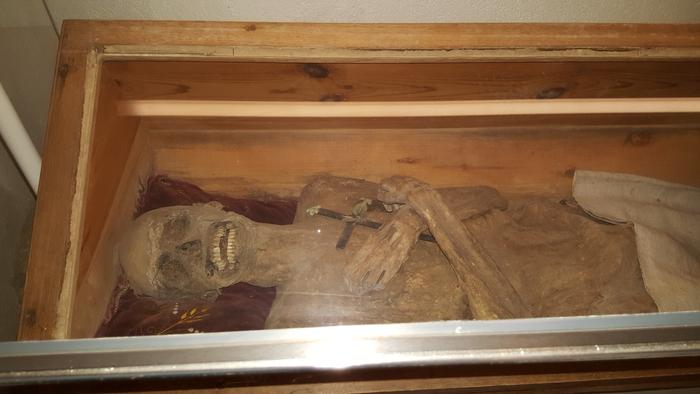 Well-Preserved Austrian Mummy Reveals Unusual Rectal Embalming Technique