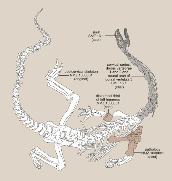 Triassic Sauropodomorph Dinosaur Suffered from Severe Bone Tissue Infection
