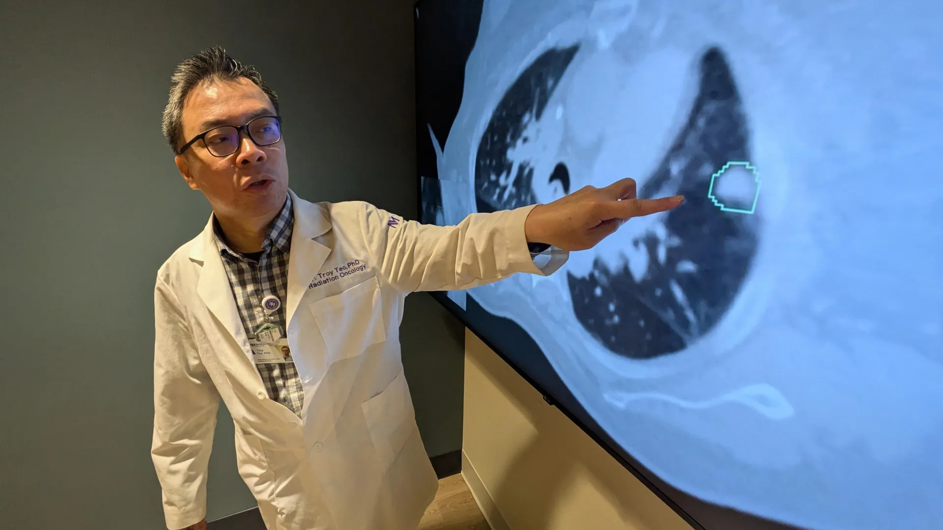 This AI tracks lung tumors as you breathe — and it might save lives