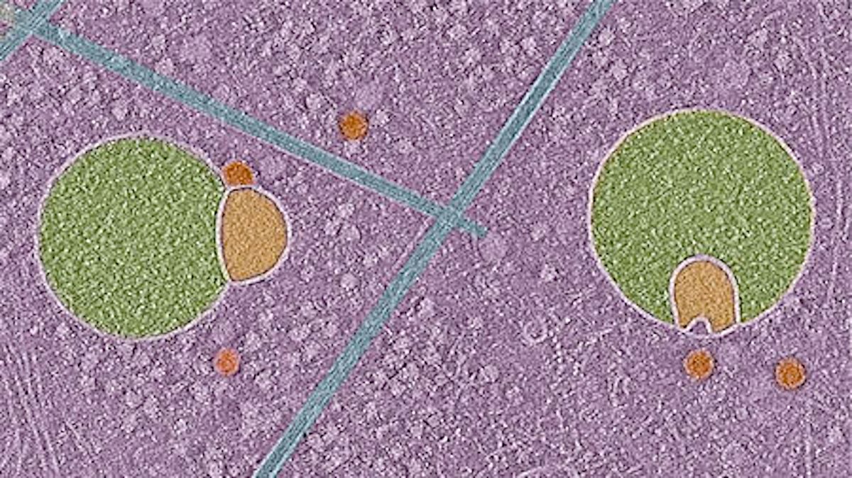 Scientists discover never-before-seen part of human cells — and it looks like a snowman wearing a scarf