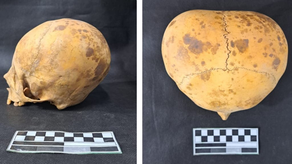 ‘Alien’ skull of toddler is actually evidence of long-standing practice of head shaping