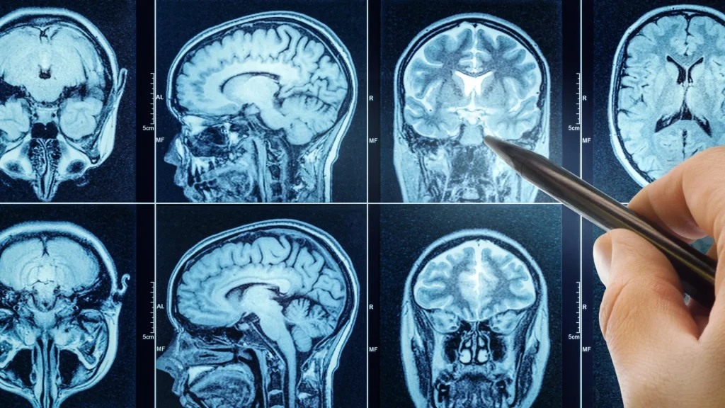 Feeling mental exhaustion? These two areas of the brain may control whether people give up or persevere