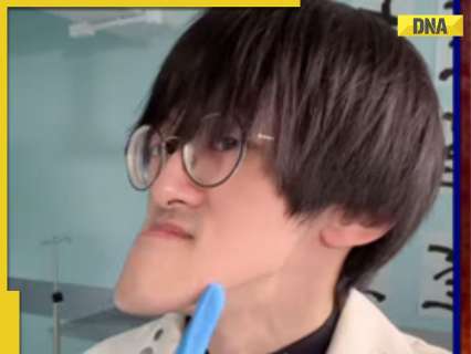 This man is ‘world’s longest-chinned YouTuber’, resembles this anime character, he faced rejected in…, is from…