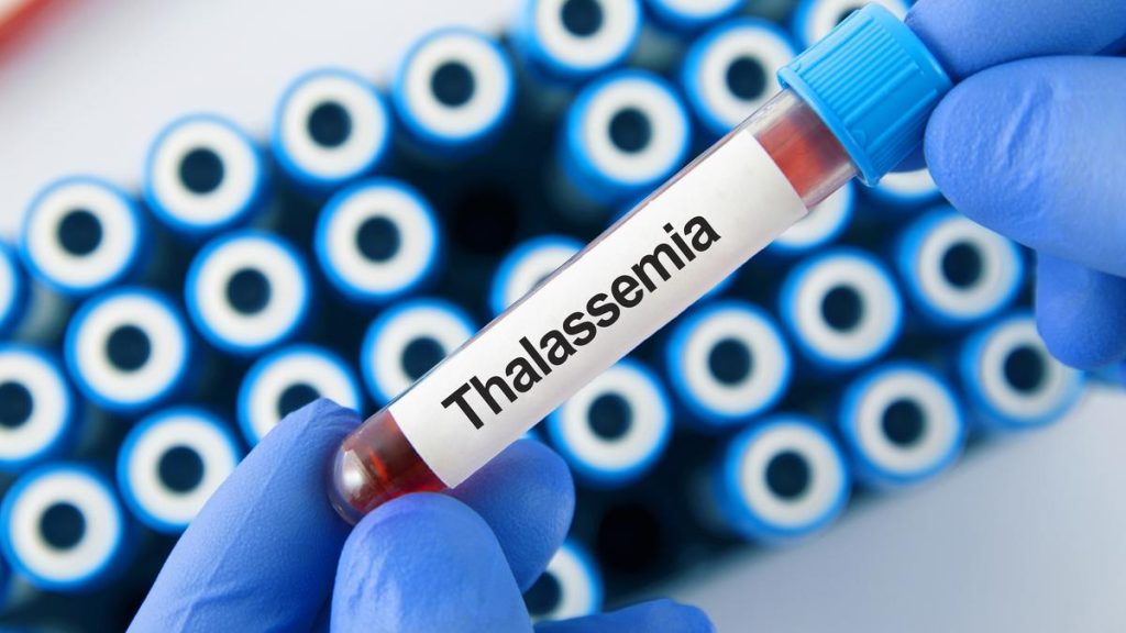 Thalassemia Patients Urge Standardized Tests to Curb Infection Risks