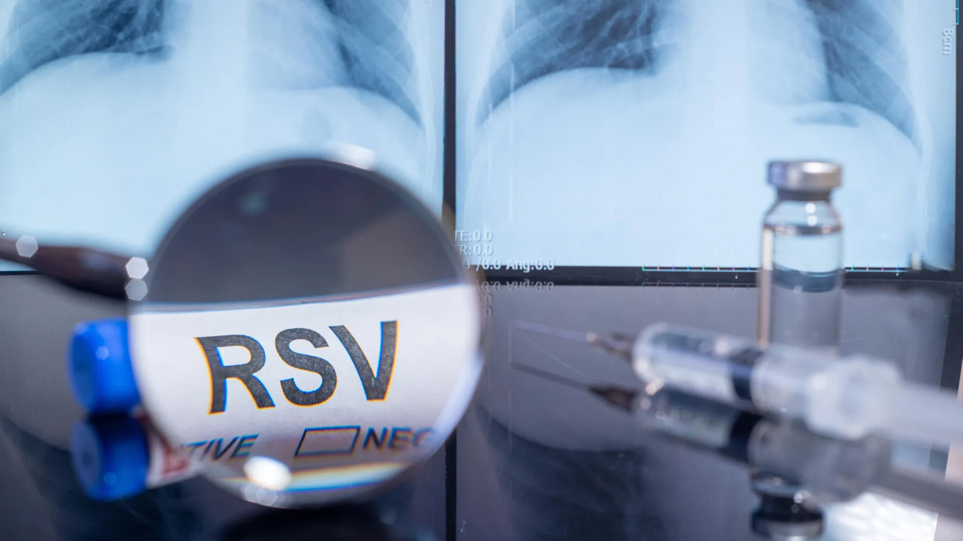 One pregnancy shot slashes baby RSV hospitalizations by 72% — and shields for months