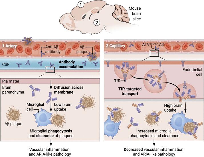 Improving Alzheimer’s disease immunotherapy | Science