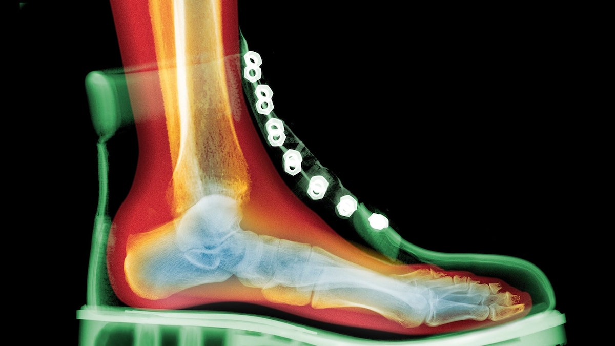 This is what happens to your body if your shoes don’t fit right