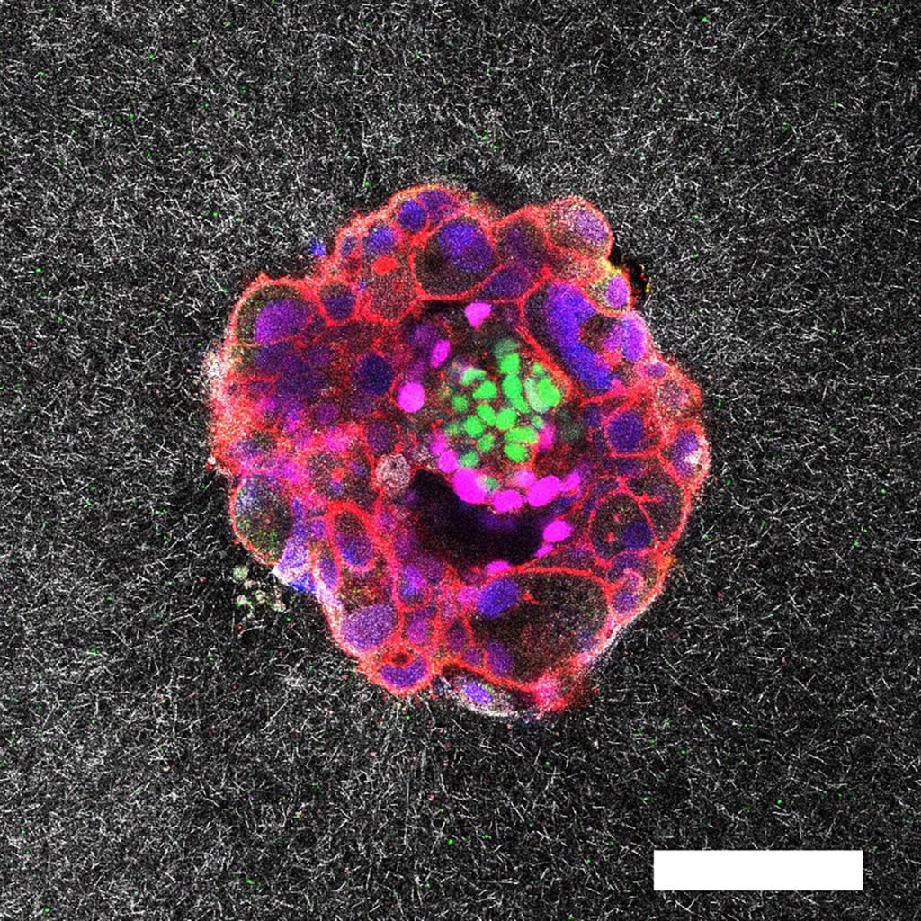 Human Embryo Implantation Revealed in First-Ever 3D Images