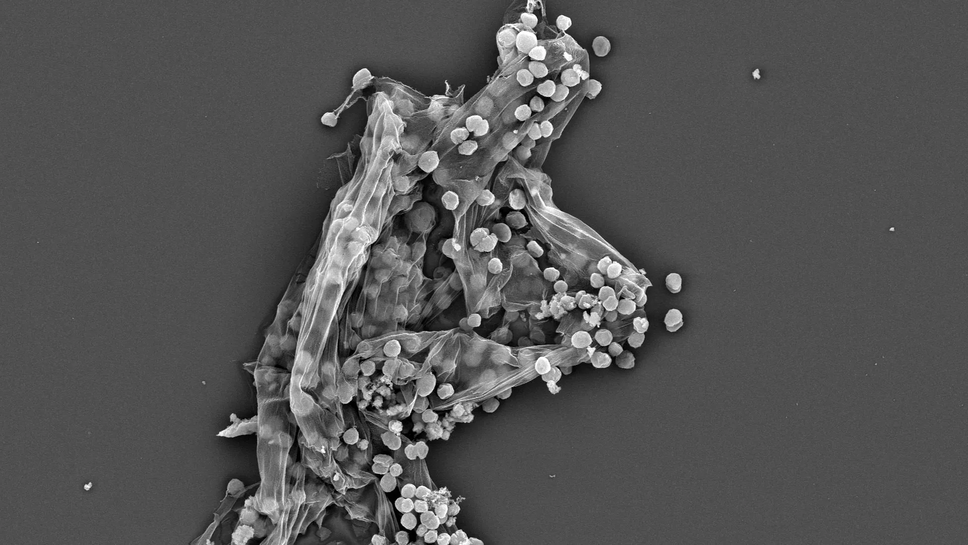 Scientists just found a hidden factor behind Earth’s methane surge