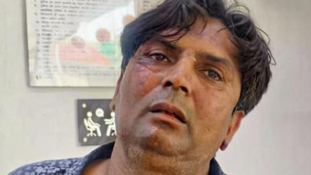 Delhi Police File Attempted Murder Case in Attack on CM Rekha Gupta