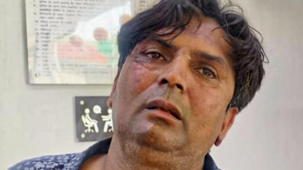 delhi-police-register-attempt-to-murder-case-in-assault-on-cm-rekha-gupta