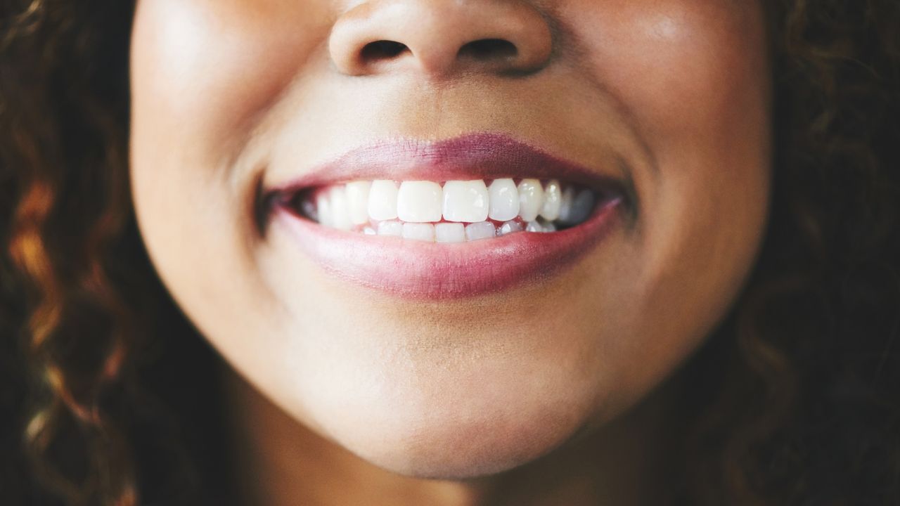 Keratin extracted from sheep’s wool repairs teeth in breakthrough