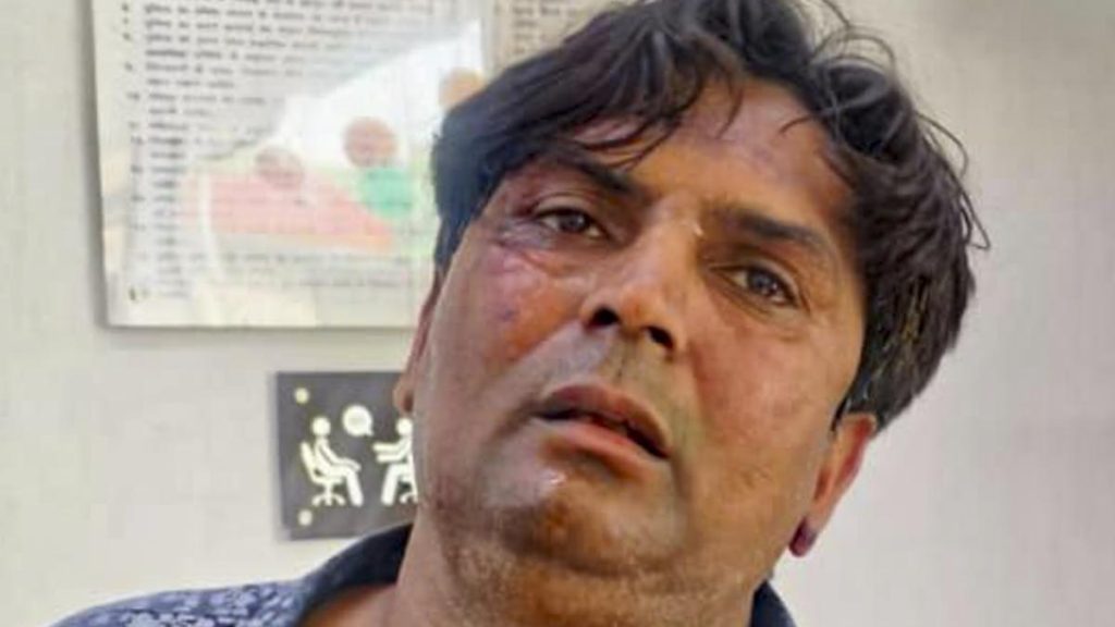 Delhi CM Attack Case: Accused Sent to 5-Day Police Custody