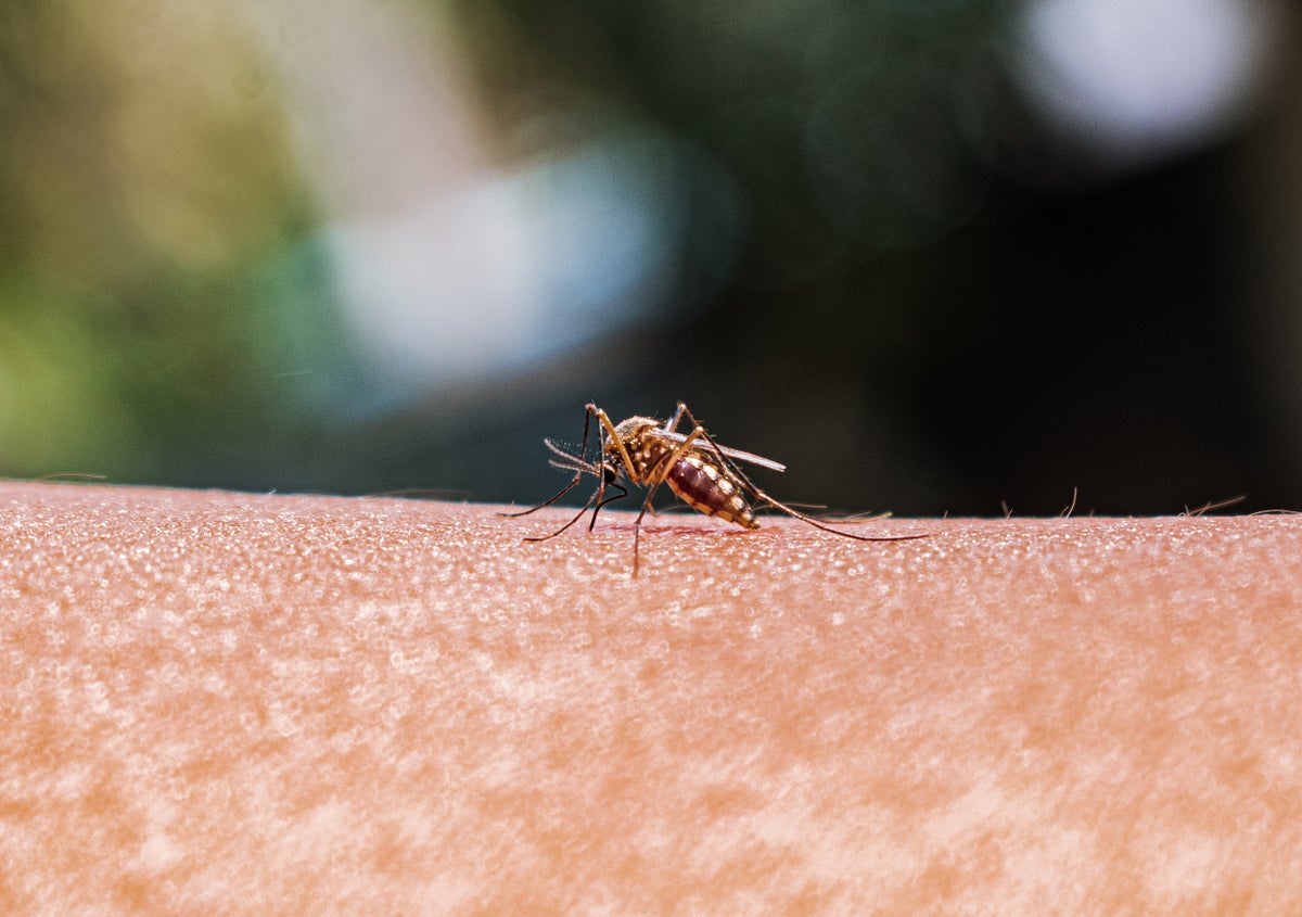 Second U.S. Malaria Case Not Tied to Travel Raises Fears of Local Transmission