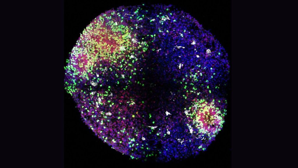 ‘Minibrains’ reveal secrets of how key brain cells form in the womb