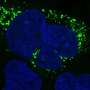 New AI tool illuminates ‘dark side’ of the human genome