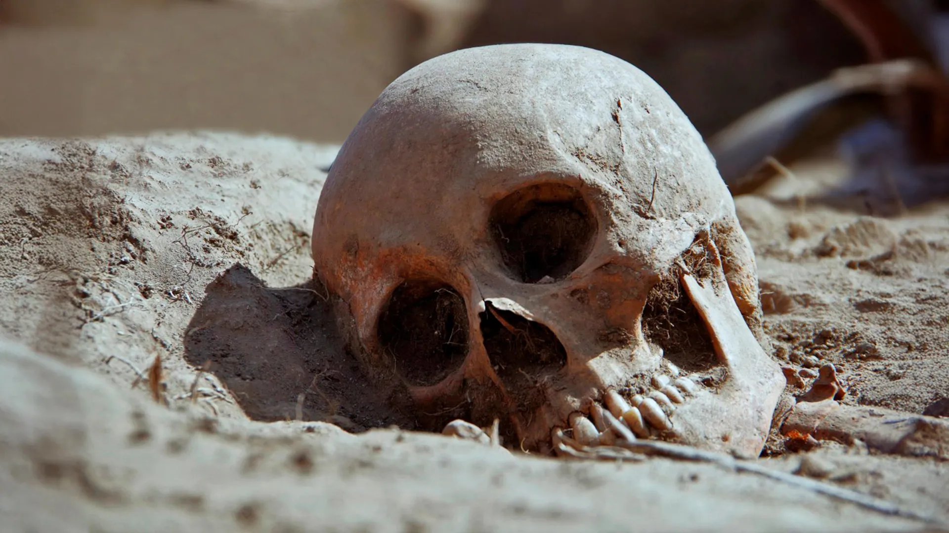 4,000-year-old teeth reveal the earliest human high — Hidden in plaque