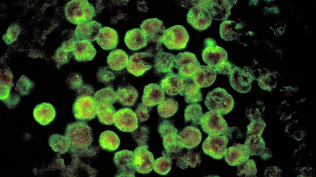 Brain-eating amoeba: Kerala reports fifth amoebic meningoencephalitis death in a month